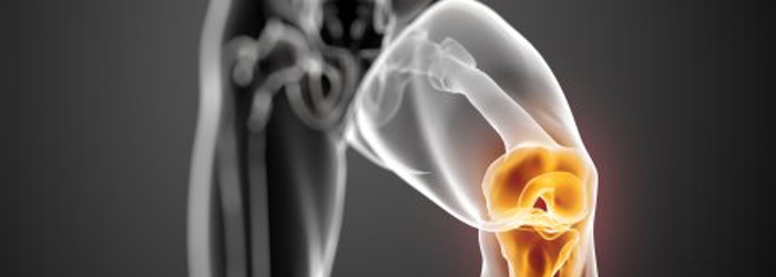 Dolor de rodilla